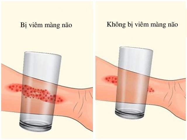 Ngày nắng nóng 4 sai lầm của bố mẹ dễ khiến con phải nhập viện - 4