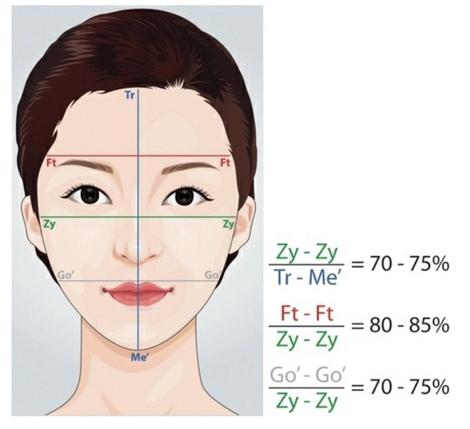 Những điều cần biết về phẫu thuật xương mặt - 2