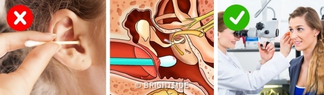 Sai lầm kinh điển khi vệ sinh cá nhân khiến bạn rước bệnh - 1