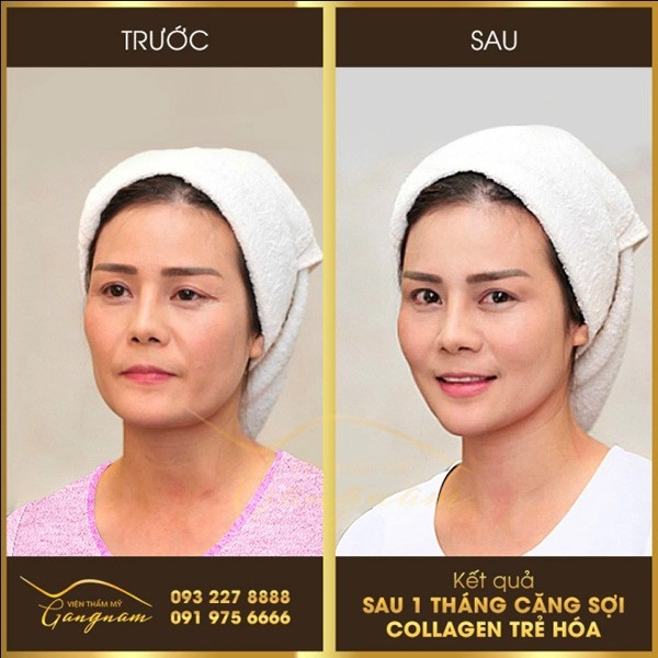 Thật hư về công nghệ trẻ đẹp vượt thời gian - 1