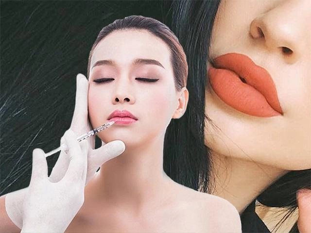 Tiêm filler làm dày môi và những dáng môi hot nhất năm 2018 các nàng cần cập nhật - 18