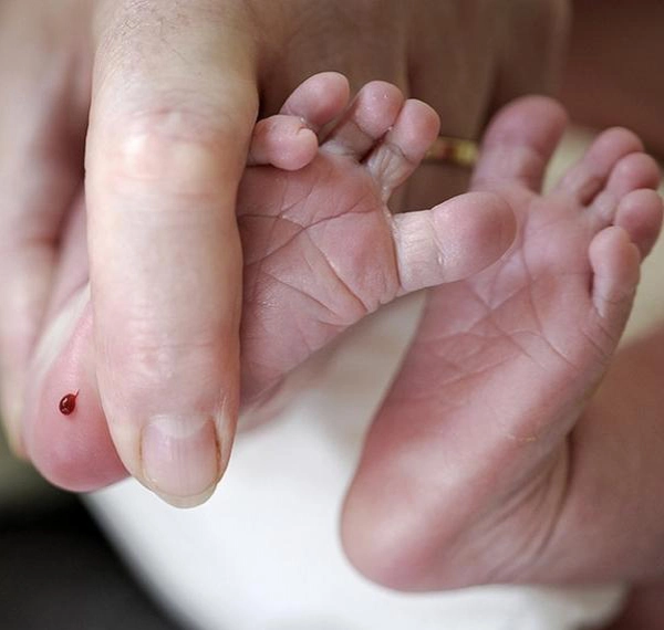 Vì sao nên bắt buộc lấy máu gót chân cho trẻ sau sinh - 2