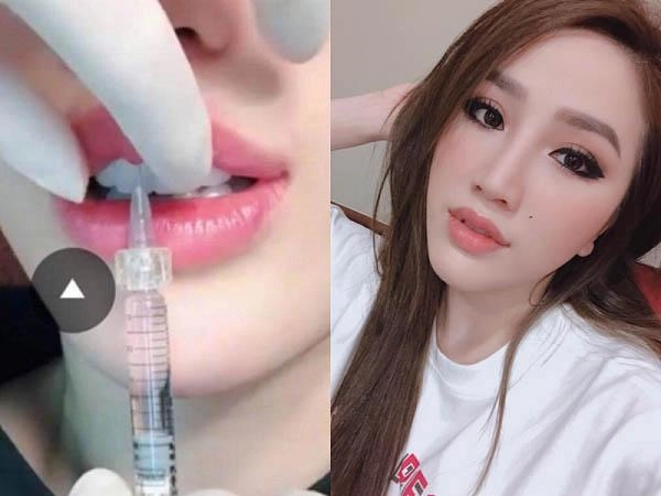 Bảo thy thưởng 10 tỷ cho ai có bằng chứng mình làm đẹp bằng dao kéo - 5