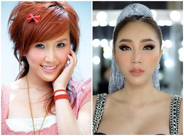 Bảo thy thưởng 10 tỷ cho ai có bằng chứng mình làm đẹp bằng dao kéo - 2