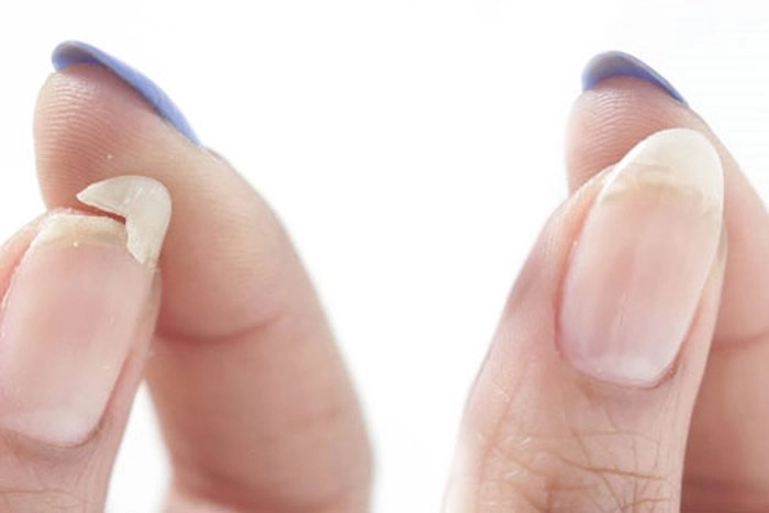 Bí quyết làm đẹp từ tỏi vừa đơn giản lại rẻ tiền bạn đã biết chưa - 5