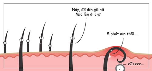 Dừng ngay việc nhổ lông nách bằng nhíp nếu không muốn rước họa vào thân - 5