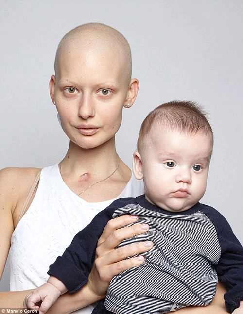 Người mẫu ung thư chấp nhận xấu xí để sinh con - 2