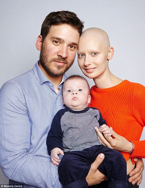 Người mẫu ung thư chấp nhận xấu xí để sinh con - 11