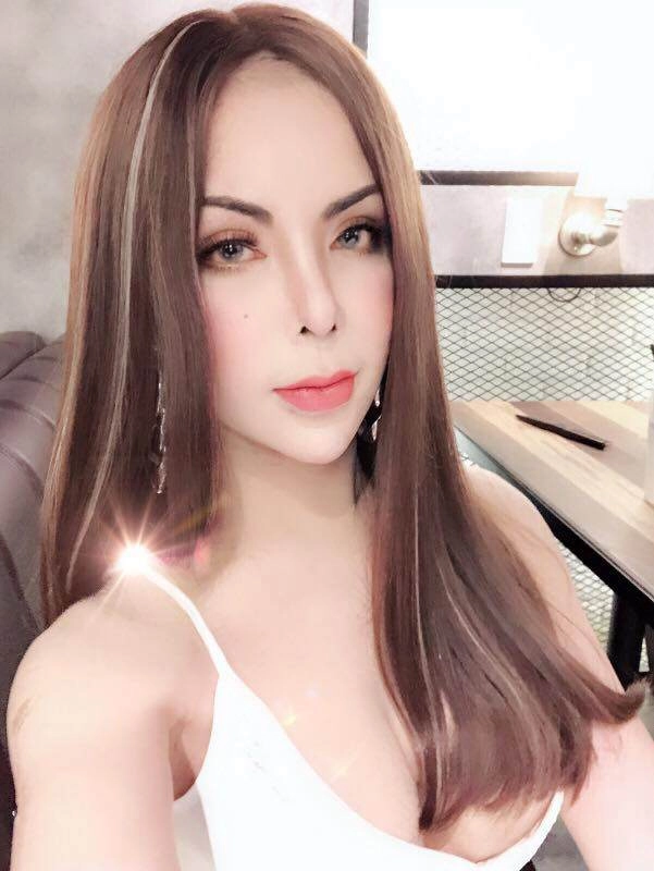 Sau biến chứng nạo silicone hot girl chuyển giới triệu followers tiếp tục khoe ảnh sửa mũi - 2