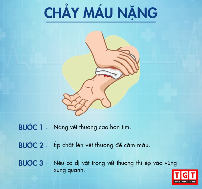 Các cách sơ cứu đúng chuẩn bạn cần nhớ - 5