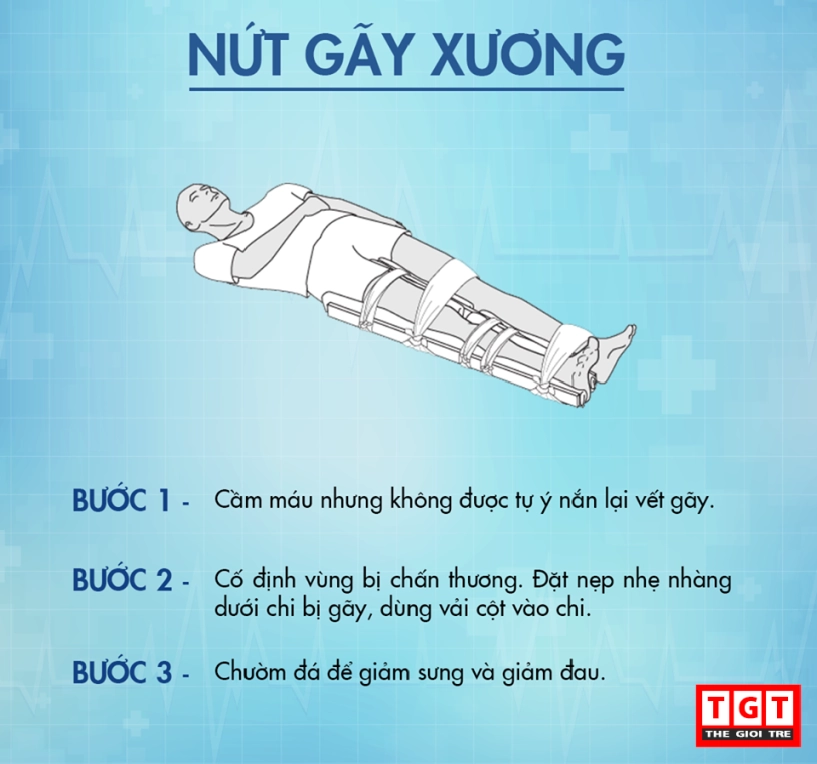 Các cách sơ cứu đúng chuẩn bạn cần nhớ - 7