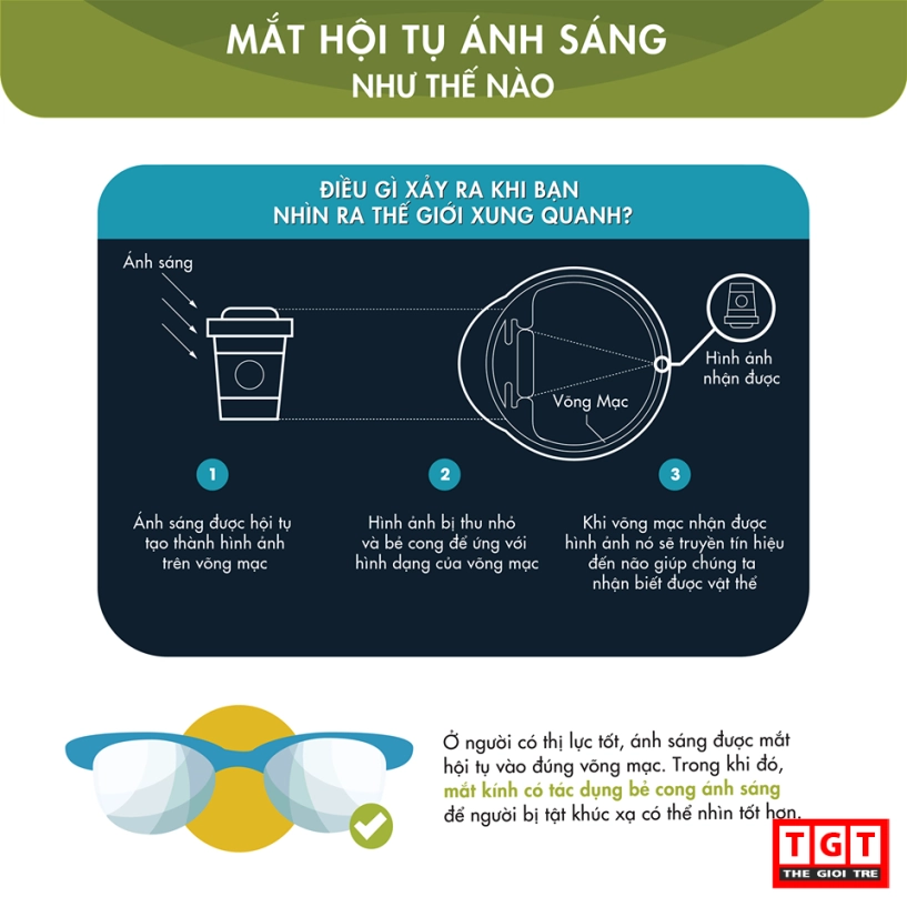 Mắt kính hoạt động như thế nào - 3