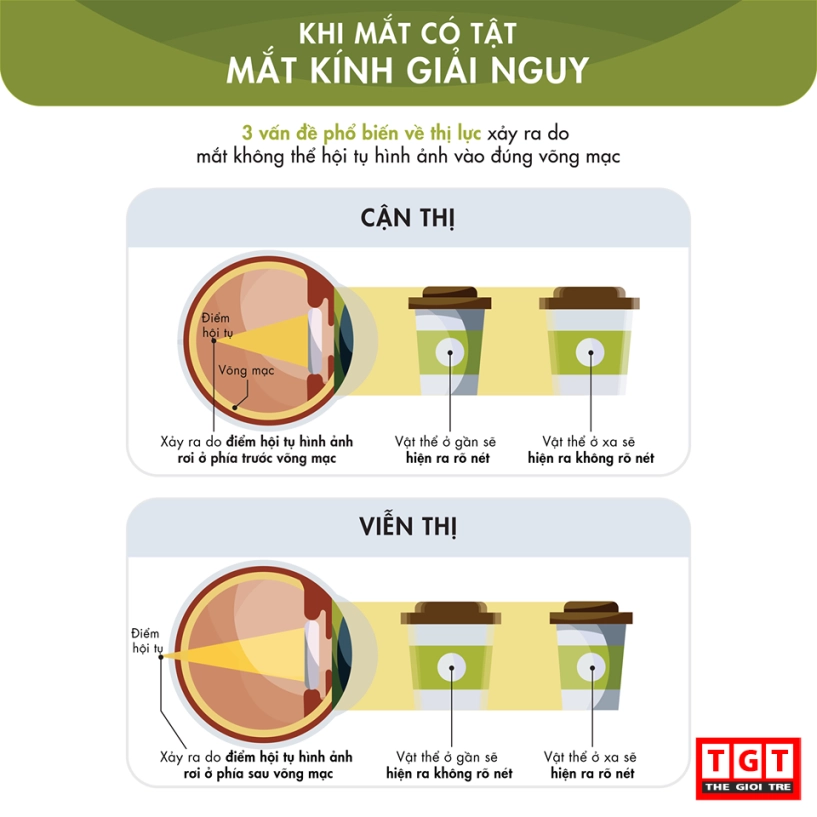 Mắt kính hoạt động như thế nào - 4