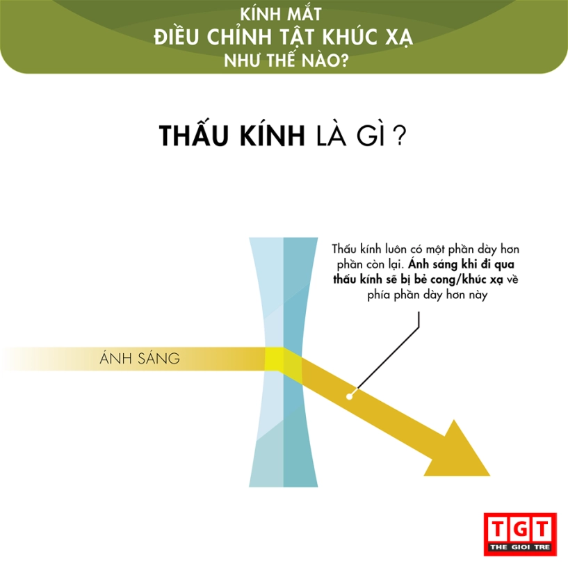 Mắt kính hoạt động như thế nào - 6