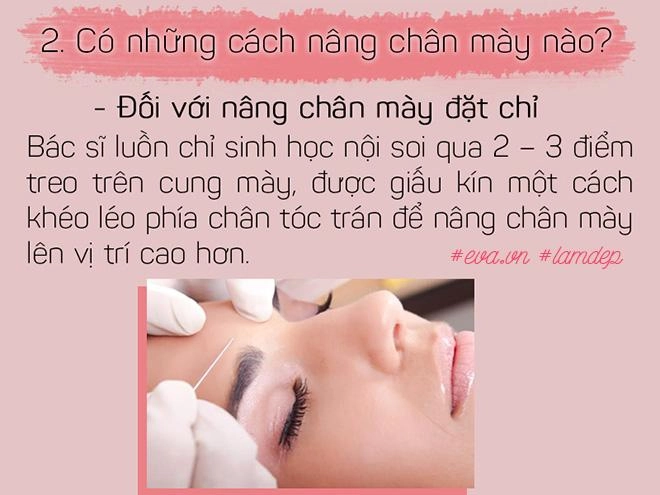 Bỏ 20 triệu chữa sụp mí bằng nâng cung chân mày chị em nhận được gì - 3