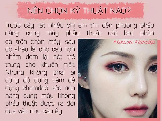 Bỏ 20 triệu chữa sụp mí bằng nâng cung chân mày chị em nhận được gì - 5