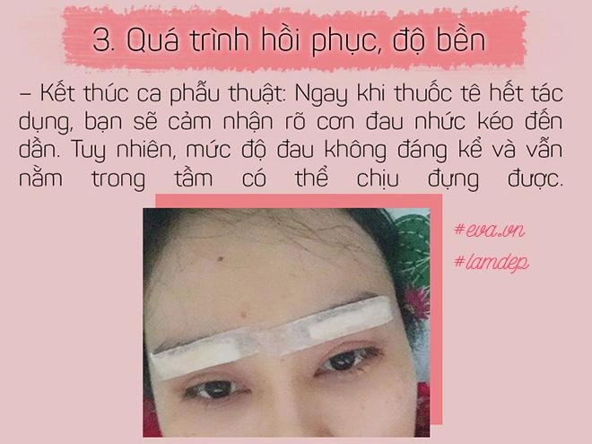 Bỏ 20 triệu chữa sụp mí bằng nâng cung chân mày chị em nhận được gì - 6