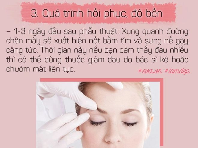 Bỏ 20 triệu chữa sụp mí bằng nâng cung chân mày chị em nhận được gì - 7