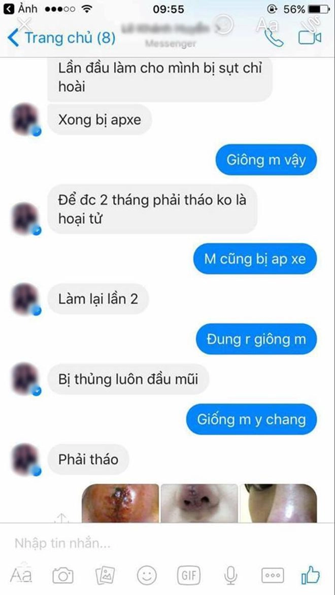 Bỏ 25 triệu làm mũi và bị hỏng cô gái phải chịu 9 lần khâu lại không thuốc tê - 8