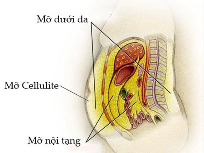 Cận cảnh một ca hút mỡ bụng khiến người phụ nữ cứng rắn nhất cũng phải bật khóc - 1