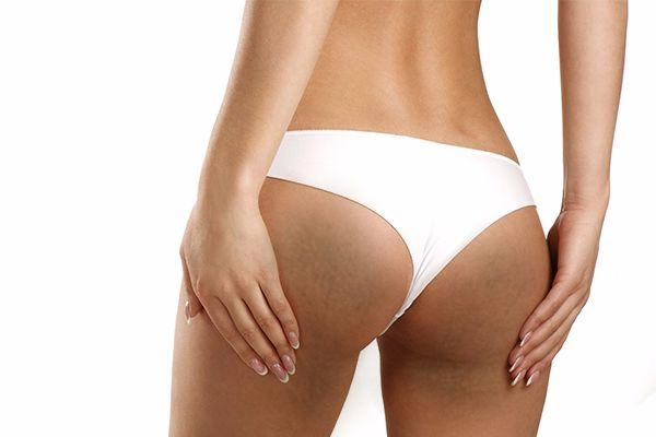 Để diện bikini hút mắt các nàng nhất định phải học cách dưỡng da toàn thân mùa hè này - 7