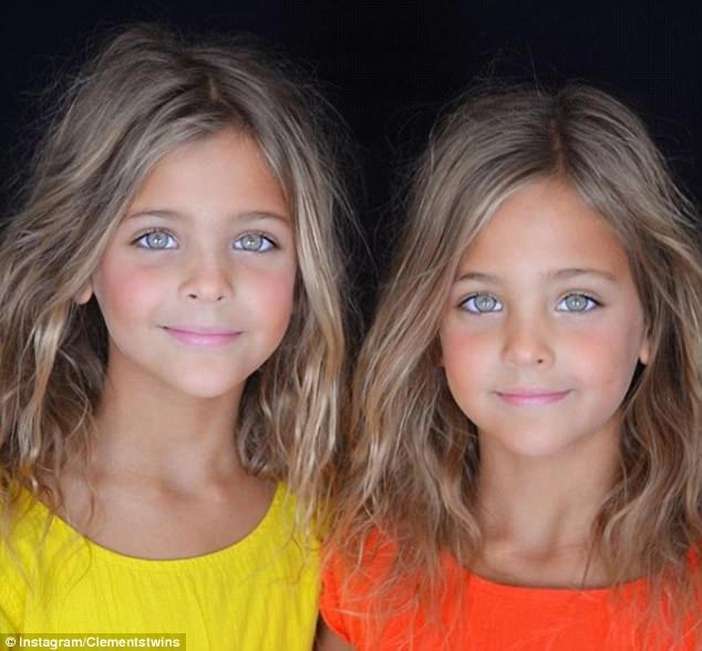 Đôi mắt của cặp song sinh 7 tuổi nổi tiếng thế giới khiến ai cũng đứng hình khi nhìn - 3