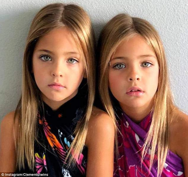 Đôi mắt của cặp song sinh 7 tuổi nổi tiếng thế giới khiến ai cũng đứng hình khi nhìn - 4