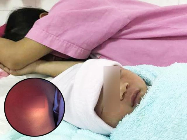 Bé gái 8 tháng tuổi mắc bệnh người lớn nguyên nhân do bà ngoại mà ra - 8