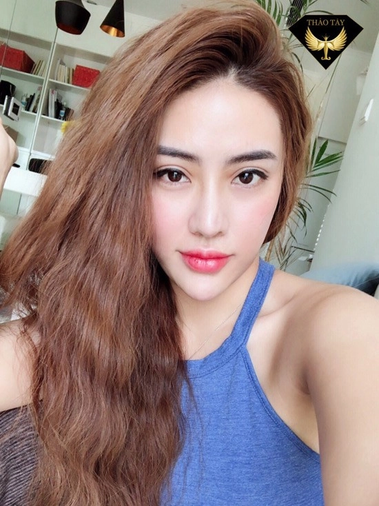 Hotgirl lột xác nhan sắc đổi đời nhờ thẩm mỹ mũi - 7