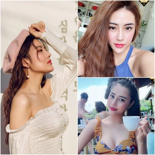 Lột xác thành hotgirl nhờ độn cằm ultrafrom - 1