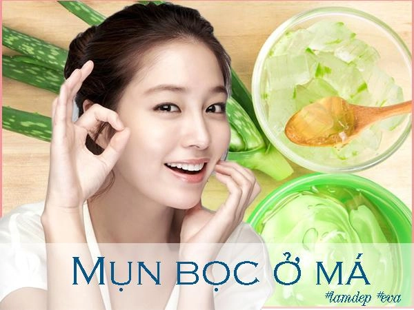 Ngày nào cũng làm theo mụn bọc ở má nặng cỡ nào cũng bị xóa mờ cực nhanh - 6