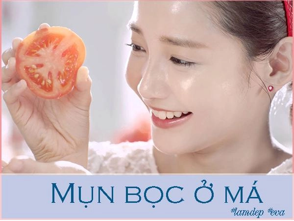 Ngày nào cũng làm theo mụn bọc ở má nặng cỡ nào cũng bị xóa mờ cực nhanh - 7