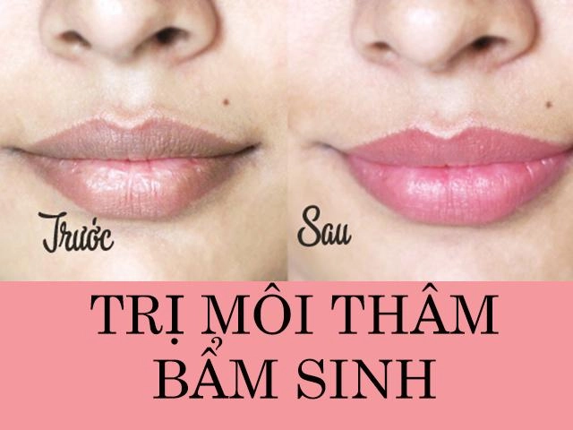 Với 5 ngàn đồng chị em có ngay cách dưỡng môi bằng mật ong khỏi cần bôi son - 7