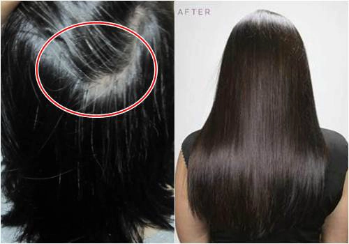 3 cách trị tóc rụng nhiều và bạc sớm với công thức từ khế chua - 6
