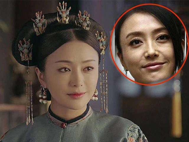 Mũi biến dạng cằm lệch một bên phi thanh vân đối diện với biến chứng sau nhiều lần dao kéo - 13