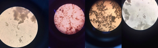Loạt ảnh mặt trăng được chia sẻ nhiều trên mxh thực chất là phân dưới kính hiển vi - 1