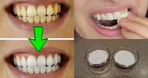 Bật mí những cách tẩy trắng răng tại nhà với nguyên liệu không thể rẻ hơn - 3