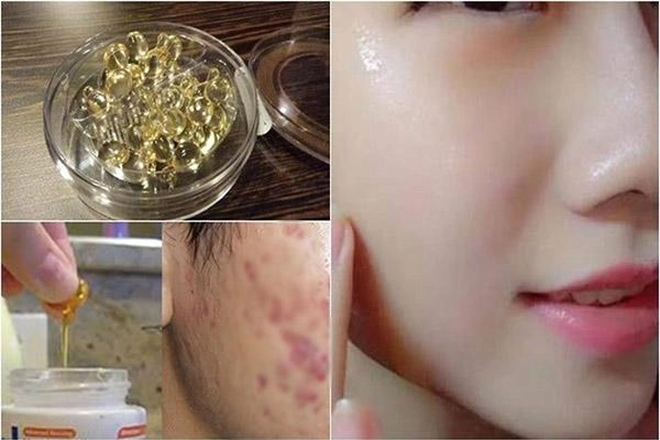 Dùng mặt nạ vitamin e có ngay làn da trắng bóc như trứng chỉ sau 2 ngày - 4