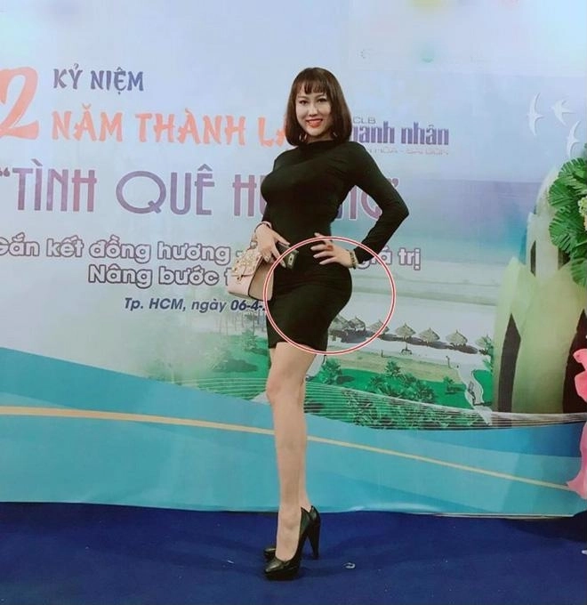 Đường đua dao kéo minh hằng cằm dài ngoằng phi thanh vân vòng ba biến dạng kỳ duyên mặt cứng đơ sưng phồng khác lạ cùng hàng loạt mỹ nhân việt nhận trái đắng - 4