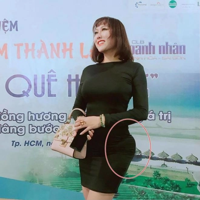 Đường đua dao kéo minh hằng cằm dài ngoằng phi thanh vân vòng ba biến dạng kỳ duyên mặt cứng đơ sưng phồng khác lạ cùng hàng loạt mỹ nhân việt nhận trái đắng - 5