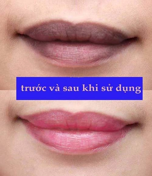 Môi thâm sạm bẩm sinh cũng sẽ mềm mịn hồng hào chỉ với công thức tự chế - 4