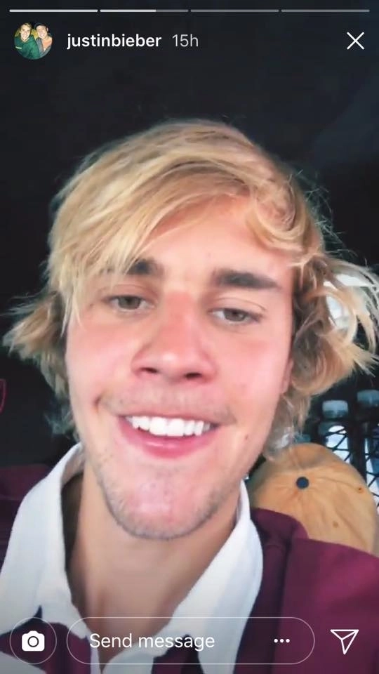 tôi đã khóc khi thấy justin bieber đăng hình trên instagram story quá xấu thật sự quá xấu - 3