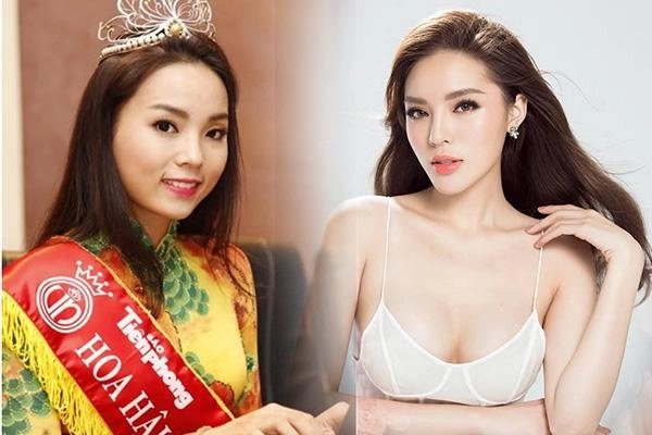 Trước nghi vấn dao kéo mỹ nhân việt người dũng cảm thừa nhận người viện lí do vụng về - 1