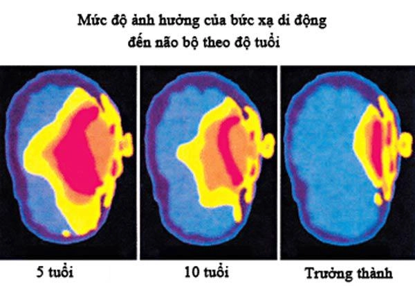 Bức ảnh tố cáo tương lai nguy hiểm của những đứa trẻ có bố mẹ nghiện điện thoại - 1