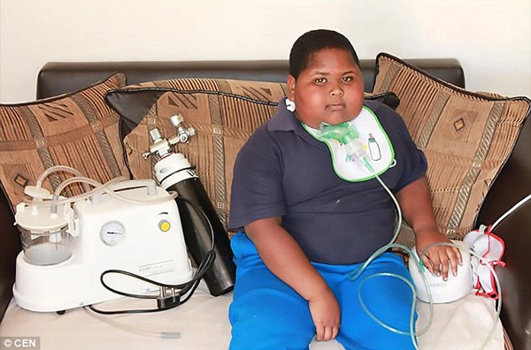 Cuộc sống hàng ngày chỉ ăn và ăn khiến cậu bé 10 tuổi đã có cân nặng quá đáng sợ - 2