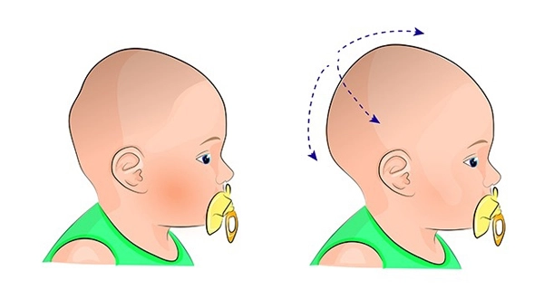 Điểm mặt 7 dấu hiệu nguy hiểm cảnh báo bé cần đi gặp bác sĩ ngay lập tức - 4