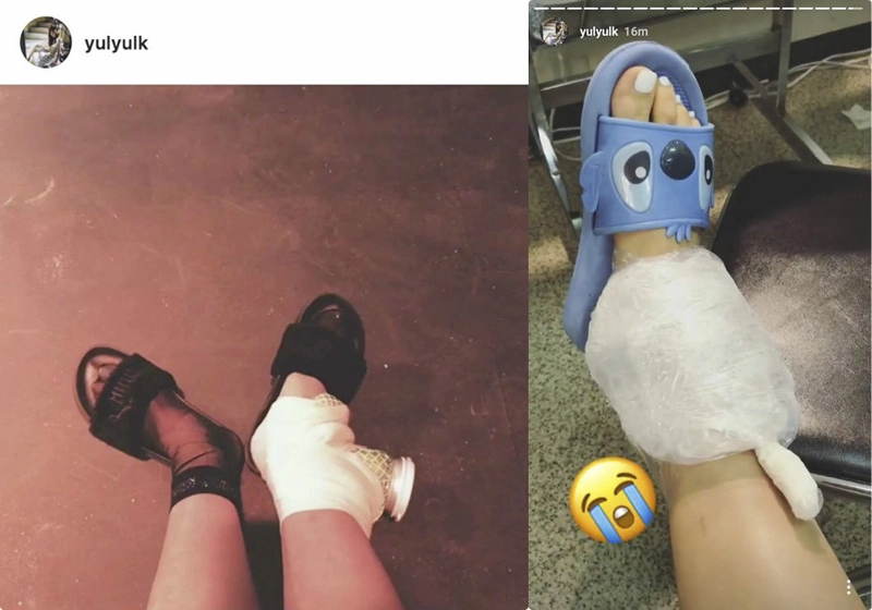 Fan lo lắng vì yuri snsd chấn thương cổ chân ngay trước ngày trở lại - 1