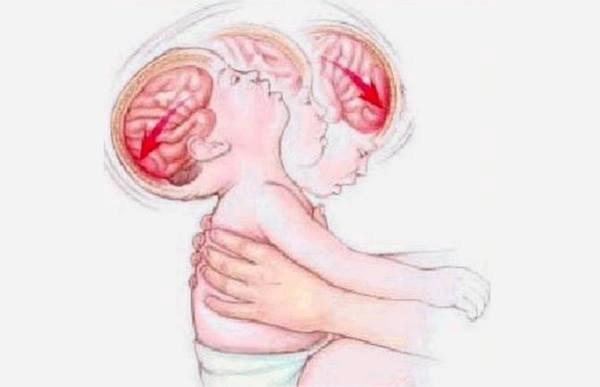 Bé 4 tháng ngã từ sofa xuống đất tử vong thủ phạm thực sự khiến tất cả căm phẫn - 4