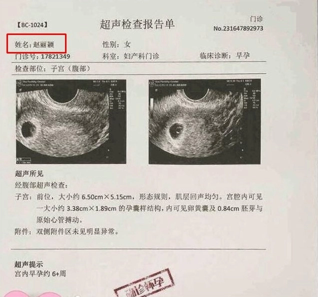 Phùng thiệu phong bị hớ khi tiết lộ triệu lệ dĩnh mang song thai - 1