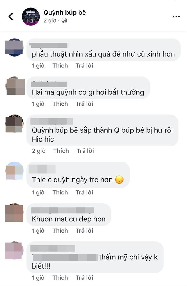 Phương oanh gây tiếc nuối với gương mặt cứng đờ được ví như búp bê bị hư - 4